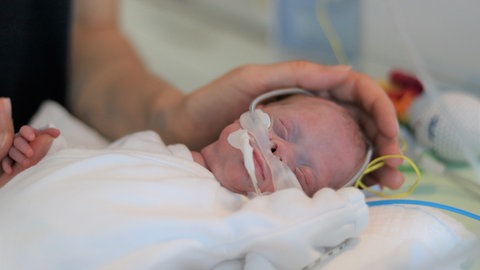 Frühchen Matheo auf der Neonatologie (Foto: Herzenssache, Michelle Habermehl) Frühchen Matheo auf der Neonatologie