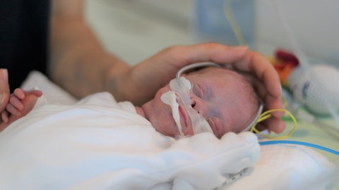 Frühchen Matheo auf der Neonatologie (Foto: Herzenssache, Michelle Habermehl)